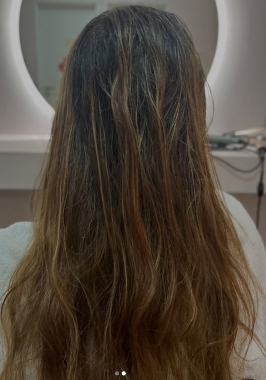 Antes do tratamento